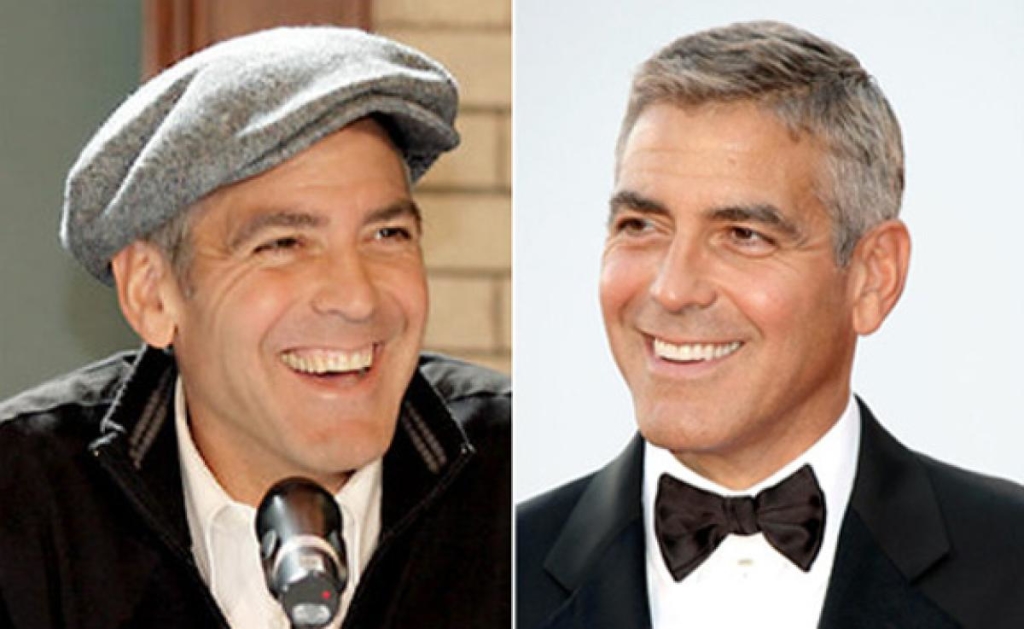 Before and after a dentist visit
